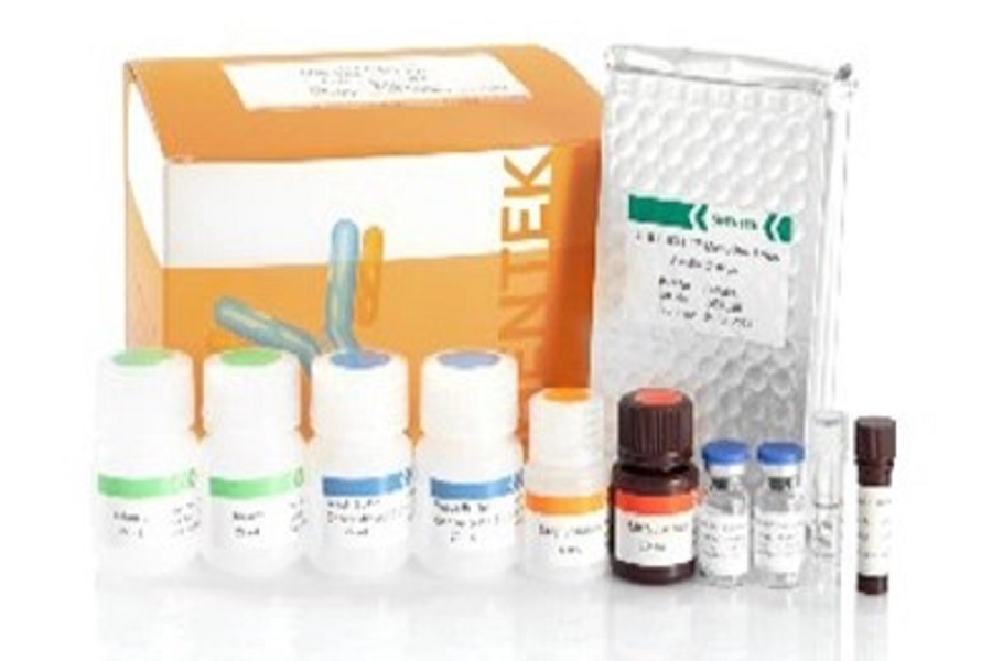 残留宿主細胞タンパク質分析の重要性と方法